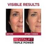 L'Oreal Paris Revitalift Triple Power Anti-Aging Face Moisturizer, Pro Retinol, Hyaluronic Acid & Vitamin C, Reduce Wrinkles 1.7 Oz - Image 4