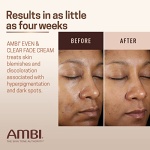 Ambi Even & Clear Fade Cream, Hydroquinone-free, Hyperpigmentation Treatment, Dark Spot Corrector, Results In As Little As 4 Weeks, Niacinamide, Aloe Vera, Vitamin C, 1 Fl Oz - Image 5