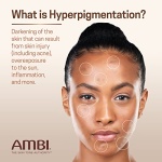 Ambi Even & Clear Advanced Fade Cream, Hydroquinone-free, Hyperpigmentation Treatment, Stubborn Dark Spot Corrector, Results In As Little 2-3 Weeks, Niacinamide, Licorice Root Extract, PHA, 1 Fl Oz - Image 8